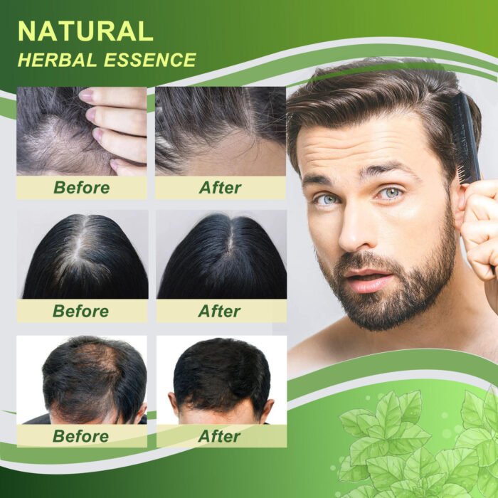 Wholesale UAZAN Custom Organic Herbal Deep Moisture Anti Hair Loss Dandruff Ginger Hair Regrowth Shampoo And Conditioner - Image 4