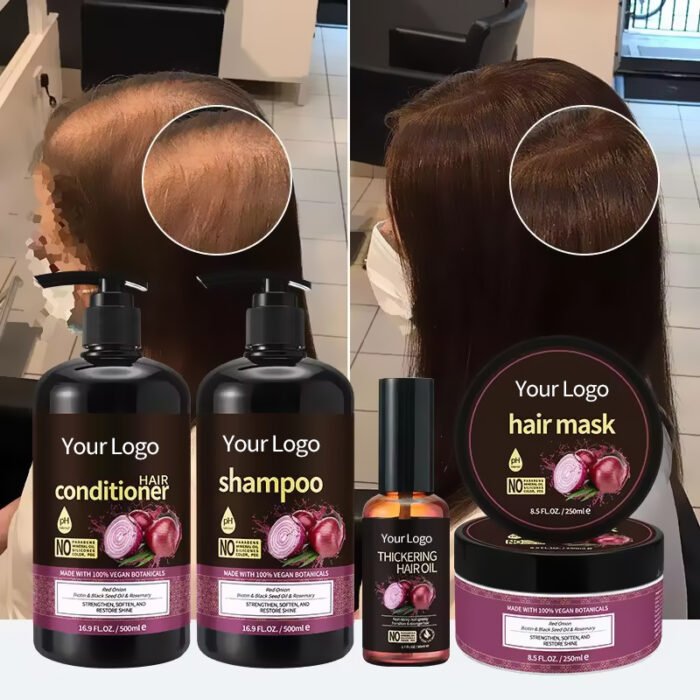 Hot Products Natural Red Onion Biotin Shampoo and Conditioner Set Anti-Dandruff Repair and Hair Regrowth Cream Product - Image 6